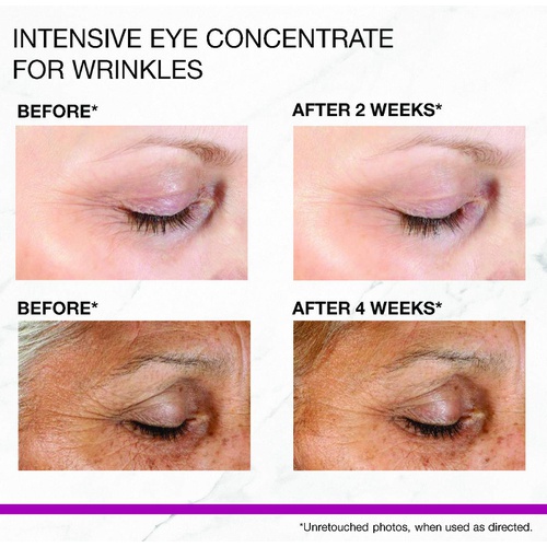 StriVectin Intensive Eye Concentrate For Wrinkles, 1 Fl Oz