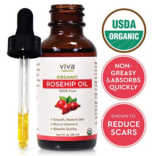  Viva Naturals Organic Rosehip Seed Oil for Face - 100% Pure Cold Pressed Facial Oil, Reduces the Appearance of Scars, Natural Non-Greasy Moisturizing Serum for Dry and Sensitive Skin, 1 oz